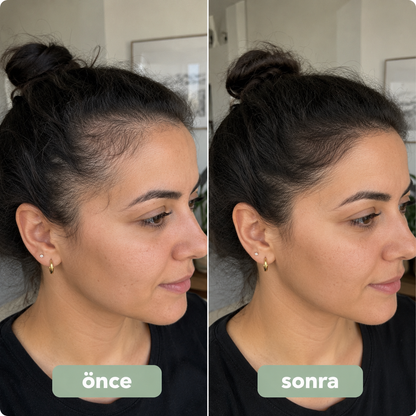 Reviora Saç Bakım Roll-On