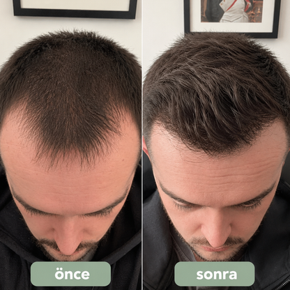 Reviora Saç Bakım Roll-On